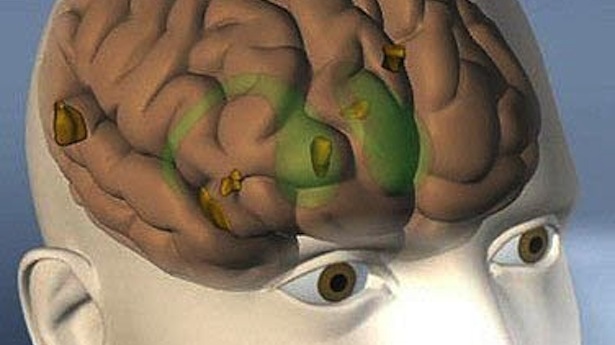 http://freedomwat.ch/wp-content/uploads/2012/12/Brain-drawing-AFP.jpe
